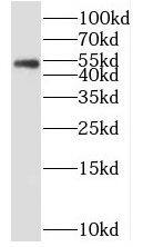 SDCCAG3 Antibody - BSA Free