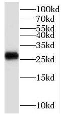 SCO2 Antibody - BSA Free