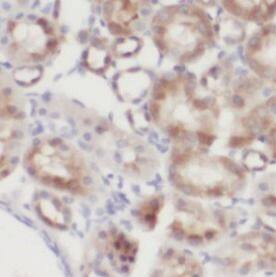 epithelial Sodium Channel alpha Antibody - BSA Free