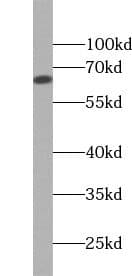 epithelial Sodium Channel alpha Antibody - BSA Free
