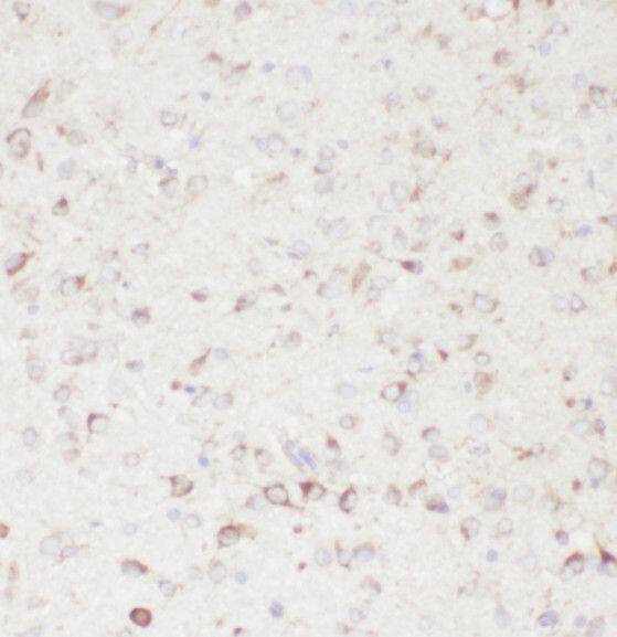 Nav1.7 Antibody - BSA Free
