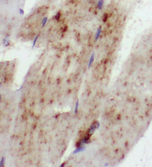 SCN4B Antibody - BSA Free