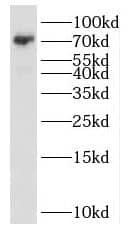 SCML2 Antibody - BSA Free
