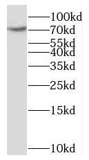SCLT1 Antibody - BSA Free