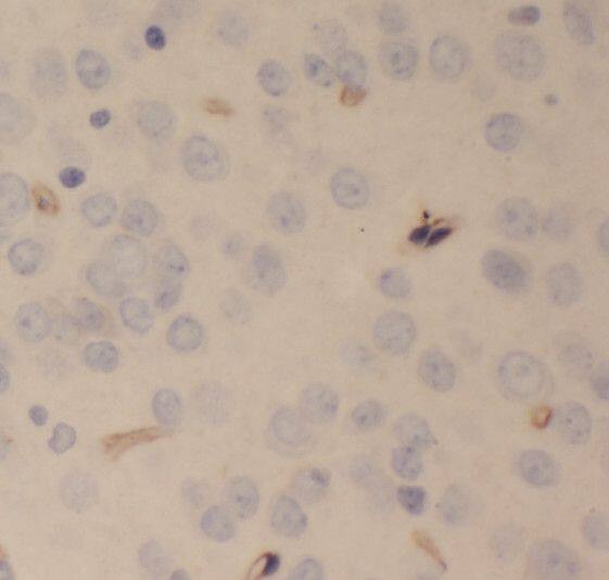 SCHIP1 Antibody - BSA Free
