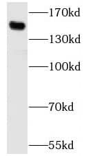 SBNO1 Antibody - BSA Free