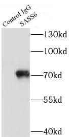 SASS6 Antibody - BSA Free