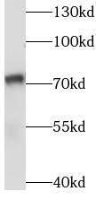 SASS6 Antibody - BSA Free
