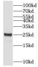 SAR1B Antibody - BSA Free