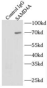 SAMD4A Antibody - BSA Free