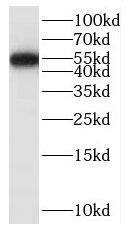 SAMD14 Antibody - BSA Free