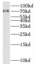 SAMD11 Antibody - BSA Free