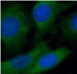 SACM1L Antibody - BSA Free