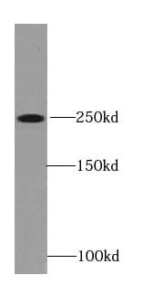 Ryanodine Receptor 2 Antibody - BSA Free