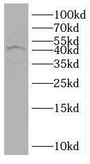 RUNDC3B Antibody - BSA Free
