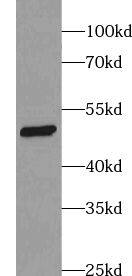 ZNF506 Antibody - BSA Free