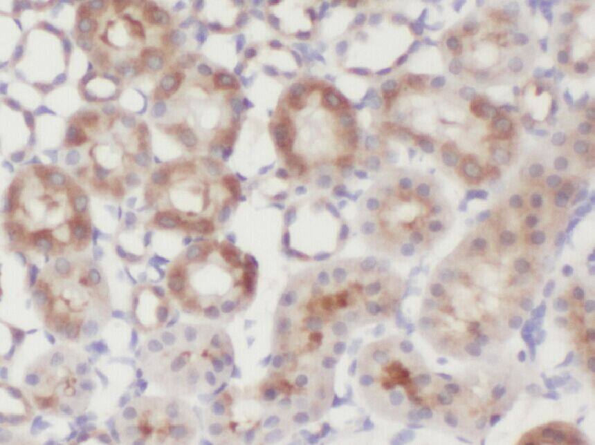 ZNF497 Antibody - BSA Free
