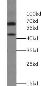 ZNF497 Antibody - BSA Free