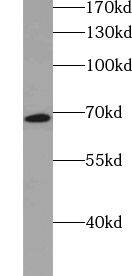Zinc finger protein 470 Antibody - BSA Free