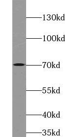 ZNF460 Antibody - BSA Free