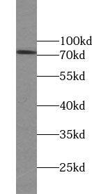 ZNF443 Antibody - BSA Free