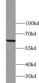 Zinc finger protein 395 Antibody - BSA Free