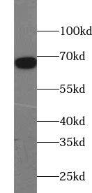 ZNF311 Antibody - BSA Free
