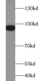 Zinc finger protein 287 Antibody - BSA Free