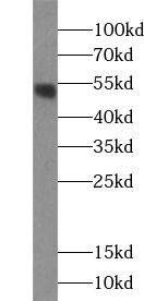 ZNF277 Antibody - BSA Free