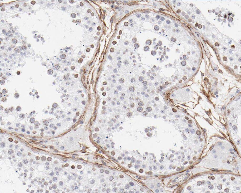 ZNF174 Antibody - BSA Free