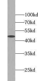 ZNF174 Antibody - BSA Free