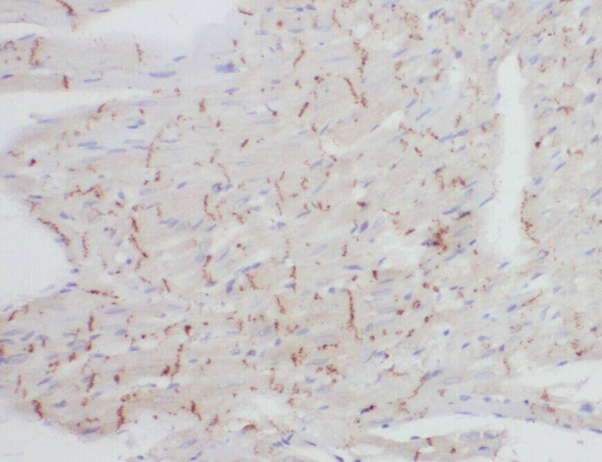 ZNF146 Antibody - BSA Free