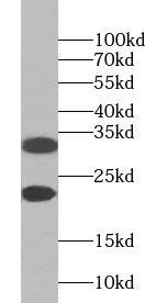 ZNF146 Antibody - BSA Free