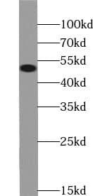 ZNF101 Antibody - BSA Free