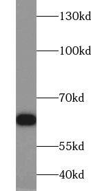 ZKSCAN1 Antibody - BSA Free