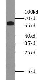 SLC39A7/ZIP7 Antibody - BSA Free