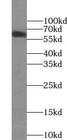 ZIM3 Antibody - BSA Free