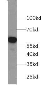 ZGPAT Antibody - BSA Free