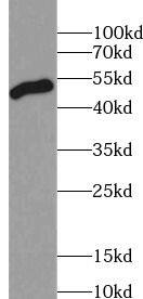 ZFYVE27 Antibody - BSA Free