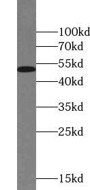 TIS11D Antibody - BSA Free