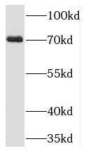 TIGD1 Antibody - BSA Free