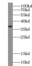 ZDHHC9 Antibody - BSA Free