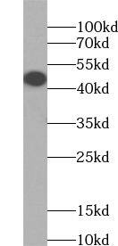 ZDHHC7 Antibody - BSA Free