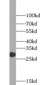 ZCRB1 Antibody - BSA Free