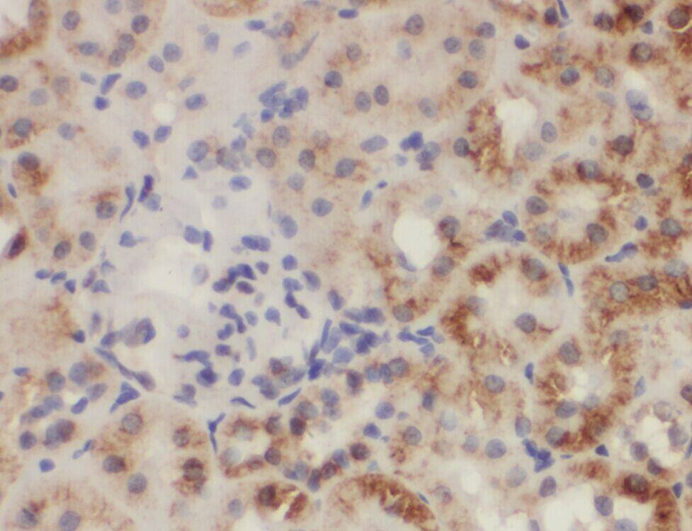 ZC3HAV1L Antibody - BSA Free