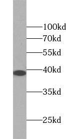 ZC3HAV1L Antibody - BSA Free