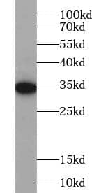 ZC3H8 Antibody - BSA Free
