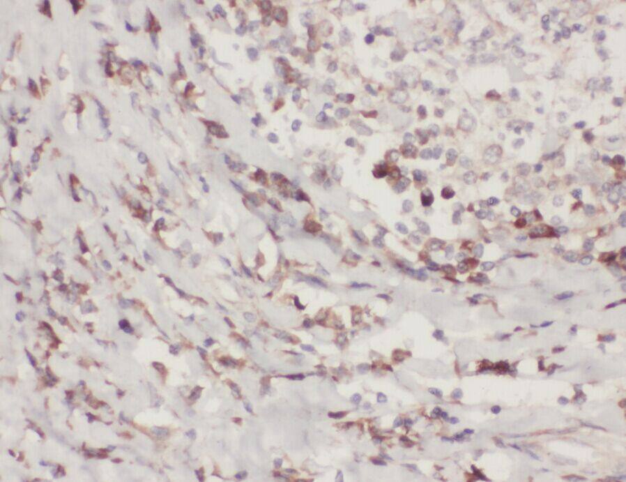 ZC3H4 Antibody - BSA Free