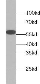 ZC3H12D Antibody - BSA Free