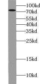 ZBTB20 Antibody - BSA Free